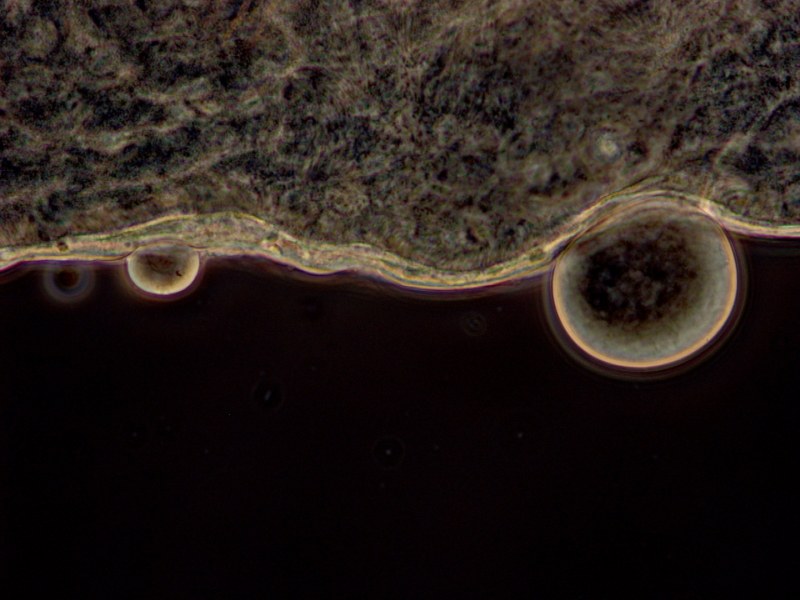 Wolbachia 2